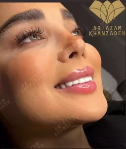 ماندگاری بیشتر ژل لب