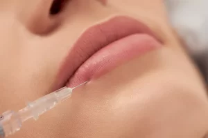 تزریق ژل - Lip Filler for Round Faces