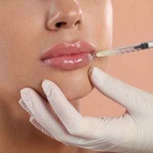lip filler cost
