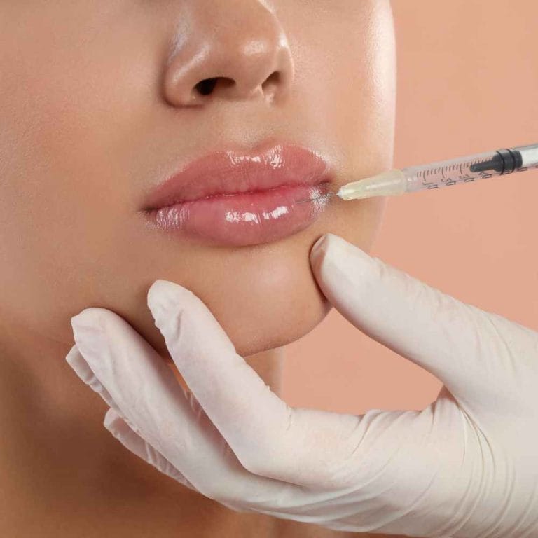 lip filler cost