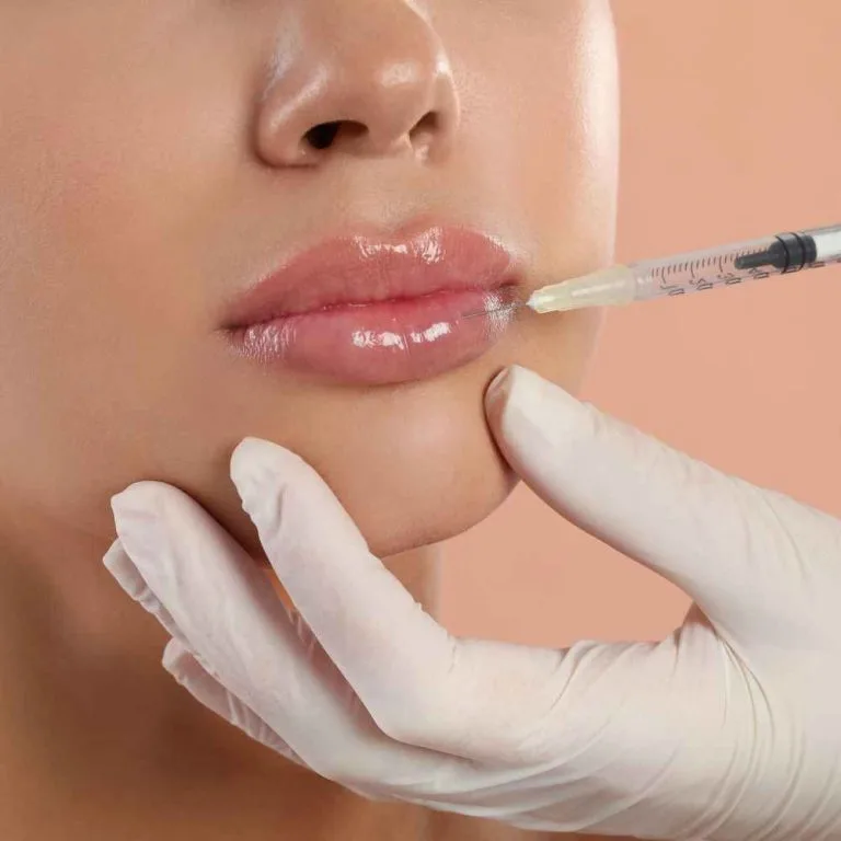 lip filler cost