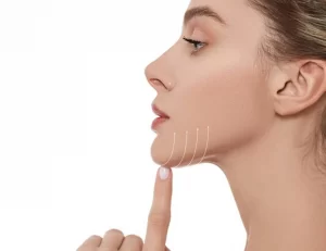 هایفوتراپی غبغب - HIFU for Double Chin