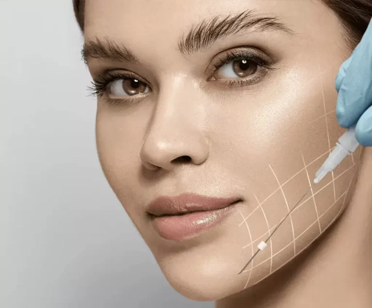 thread face lift