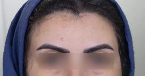 بهترین دکتر زیبایی مشهد