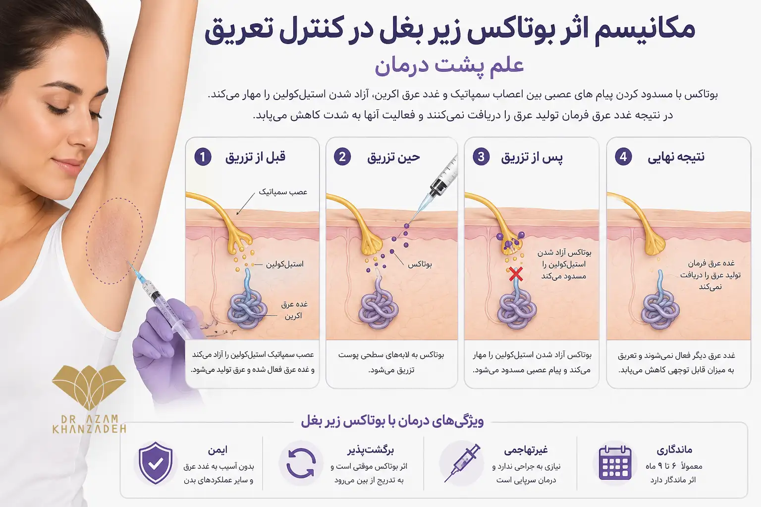 مکانیسم کاهش تعریق زیر بغل با مهار موقت آزادسازی استیل کولین